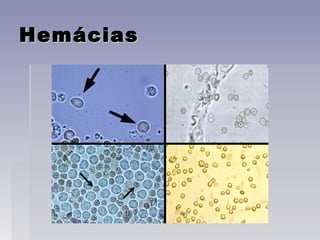 HemáciasHemácias
 
