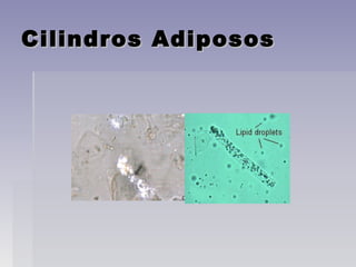 Cilindros AdipososCilindros Adiposos
 