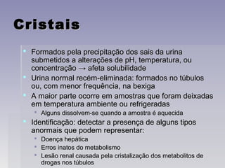 CristaisCristais
 Formados pela precipitação dos sais da urinaFormados pela precipitação dos sais da urina
submetidos a alterações de pH, temperatura, ousubmetidos a alterações de pH, temperatura, ou
concentraçãoconcentração → afeta solubilidade→ afeta solubilidade
 Urina normal recém-eliminada: formados no túbulosUrina normal recém-eliminada: formados no túbulos
ou, com menor frequência, na bexigaou, com menor frequência, na bexiga
 A maior parte ocorre em amostras que foram deixadasA maior parte ocorre em amostras que foram deixadas
em temperatura ambiente ou refrigeradasem temperatura ambiente ou refrigeradas
 Alguns dissolvem-se quando a amostra é aquecidaAlguns dissolvem-se quando a amostra é aquecida
 Identificação: detectar a presença de alguns tiposIdentificação: detectar a presença de alguns tipos
anormais que podem representar:anormais que podem representar:
 Doença hepáticaDoença hepática
 Erros inatos do metabolismoErros inatos do metabolismo
 Lesão renal causada pela cristalização dos metabolitos deLesão renal causada pela cristalização dos metabolitos de
drogas nos túbulosdrogas nos túbulos
 