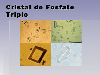 Cristal de FosfatoCristal de Fosfato
TriploTriplo
 