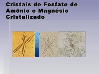 Cristais de Fosfato deCristais de Fosfato de
Amônio e MagnésioAmônio e Magnésio
CristalizadoCristalizado
 