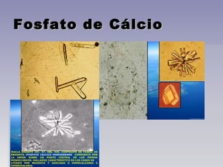 Fosfato de CálcioFosfato de Cálcio
 