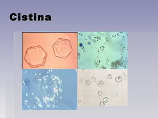 CistinaCistina
 