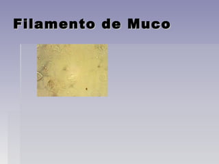 Filamento de MucoFilamento de Muco
 