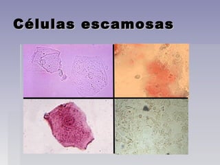 Células escamosasCélulas escamosas
 