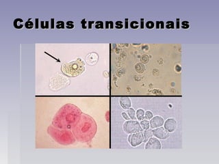 Células transicionaisCélulas transicionais
 