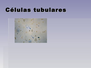 Células tubularesCélulas tubulares
 