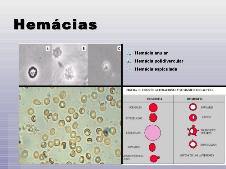 ATLAS DE SEDIMENTOS URINARIOS EPUB ATLAS DE SEDIMENTOS URINARIOS EPUB