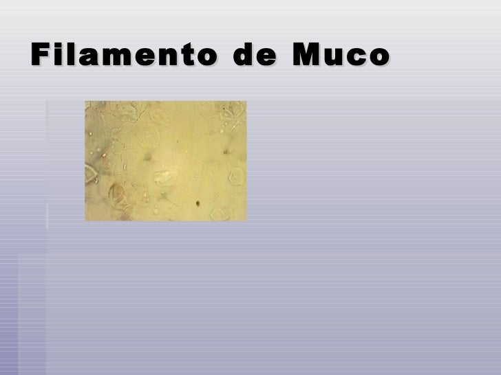 O Que Significa Presença De Filamentos De Muco Na Urina