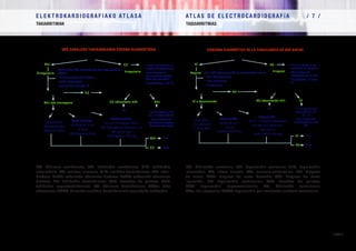E L E K T R O K A R D I O G R A F I A K O AT L A S A 			 AT L A S D E E L E C T R O C A R D I O G R A F í A / 7 /
TAKIARRITMIAK TAQUIARRITMIAS
/ 246 /
FA: fibrilazio aurikularra; TA: takikardia aurikularra; TIN: takikardia
intranodala; RS: erritmo sinusala; A-B: aurikulo-bentrikularra; AB: adar-
blokeoa; EsAB: eskuineko adarraren blokeoa; EzAB: ezkerreko adarraren
blokeoa; TB: takikardia bentrikularra; TdP: torsades de pointes; TSB:
takikardia suprabentrikularra; FB: fibrilazio bentrikularra; BAkz: bide
akzesorioa: BABT: birsartze aurikulo-bentrikularrak eragindako takikardia.
FA: fibrilación auricular; TA: taquicardia auricular; TIN: taquicardia
intranodal; RS: ritmo sinusal; AV: auriculo-ventricular; BR: bloqueo
de rama; BRD: bloqueo de rama derecha; BRI: bloqueo de rama
izquierda; TV: taquicardia ventricular; TdP: torsades de pointes;
TSV: taquicardia supraventricular; FV: fibrilación ventricular;
VAc: vía accesoria; TRAV: taquicardia por reentrada aurículo-ventricular.
 