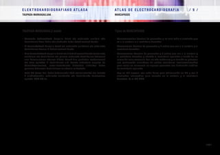 E L E K T R O K A R D I O G R A F I A K O AT L A S A 			 AT L A S D E E L E C T R O C A R D I O G R A F í A / 9 /
TAUPADA-MARKAGAILUAK MARCAPASOS
/ 301 /
TAUPADA-MARKAGAILU motak Tipos de MARCAPASOS
–	Barrunbe bakarrekoak: Sorgailu batek eta eskuineko aurikula edo
bentrikulura doan kable edo elektrodo bakar batek osatuak daude.
–	Bi barrunbekoak: Sorgailu batek eta eskuineko aurikulara eta eskuineko
bentrikulura doazen 2 kablek osatuak daude.
–	Hiru barrunbekoak: Sorgailu batek eta 3 kablek osatuak daude (eskuineko
aurikulara eta bentrikulura eta gainera ezkerreko bentrikulura doazenak
sinu koronarioaren adarren bidez). Hauek dira guztietan modernoenak
eta bere egitekoa bi bentrikuluen aldi bereko uzkurdura eragitea da
(birsinkronizazioa), ezker-bentrikuluko disfuntzio sistolikoa duten
paziente batzuetan bentrikuluen asinkronia saihesteko.
–	 Bada TM berezi bat, kable bakarrarekin (EsB estimulatzeko) eta tarteko
2 elektrodorekin, eskuineko aurikulako eta bentrikuluko hautematea
egiteko. VDD TM da.
–	Monocamerales: Constan de generador y un solo cable o electrodo que
va a la aurícula o al ventrículo derechos.
–	Bicamerales: Constan de generador y 2 cables que van a la aurícula y al
ventrículo derechos.
–	Tricamerales: Constan de generador y 3 cables que van a la aurícula y
al ventrículo derechos y además al ventrículo izquierdo a través de las
ramas del seno coronario. Son los más modernos y su función es provocar
una contracción simultánea de ambos ventrículos (resincronización)
para evitar su asincronía en algunos pacientes con disfunción sistólica
de ventrículo izquierdo.
–	 Hay un MP especial con cable único para estimulación en VD y con 2
electrodos intermedios para sensado en la aurícula y el ventrículo
derechos. Es el MP VDD
 