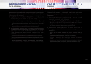 E L E K T R O K A R D I O G R A F I A K O AT L A S A 			 AT L A S D E E L E C T R O C A R D I O G R A F í A / 9 /
TAUPADA-MARKAGAILUAK MARCAPASOS
/ 306 /
Problemas de sensado: El marcapasos puede sensar por exceso
(sobresensado) o por defecto (infrasensado). Pueden ser temporales o
permanentes.
1.	 Infrasensado: No detecta la señal intrínseca de la cámara en que está
implantado el electrodo. Puede obedecer a:
–	 que la señal sea pequeña, ya desde el implante o con el tiempo
–	 Mala programación: hemos programado un tamaño de señal a detectar
más grande del de la señal que tenemos en ese punto
–	 Los motivos señalados en mal umbral de estimulación
2.	 Sobresensado: Detecta señales que no debería y que hacen al
marcapasos inhibirse. Más fácil con sensado monopolar. Puede
obedecer a:
–	 Señales de otra cámara cardíaca por estar el electrodo cerca de
ésta.
–	 Miopotenciales (contracciones, sobre todo del pectoral).
–	 Daños en el electrodo o mala conexión al generador que generan
“ruido”.
–	 Interferencias externas (litotricia, radiofrecuencia, bisturí eléctrico,
resonancia magnética, radioterapia, máquinas tragaperras, etc.).
Hautematearen arazoak:Taupada-markagailuakgehiegihautemandezake
(gain-hautematea) edo gutxiegi (azpi-hautematea). Arazoak izan daitezke
aldi baterakoak edo iraunkorrak.
1.	 Azpi-hautematea: Ez du hautematen elektrodoa ezarria dagoeneko
barrunbearen seinale intrintsekoa. Eta hori gerta daiteke:
–	 seinalea txikia delako, ezarri zen unetik edo denboraren eraginez
–	 programazio txarragatik: programatu dugun hauteman beharreko
seinalearen tamaina puntu horretan dugun seinalea baino handiagoa
da
–	 estimulazioko atalase txarrean adierazitako arrazoiengatik
2.	 Gain-hautematea: Hauteman behar ez lituzkeen seinaleak hautematen
ditu, eta horregatik taupada-markagailua inhibitu egiten da. Errazago
hautemate monopolarrarekin. Hauek dira hori gertatzearen arrazoiak:
–	 Beste bihotz-barrunbe baten seinaleak, elektrodoa hortik hurbil
dagoelako
–	 Miopotentzialak (uzkurdurak, bularreko muskuluarenak batez ere).
–	 Kalteak elektrodoan edo sorgailurako konexio txarra. Horrek “zarata”
eragiten du.
–	 Kanpoko interferentziak (litotrizia, irratifrekuentzia, bisturi elektrikoa,
erresonantzia magnetikoa, erradioterapia, makina txanponjaleak, etab.).
 