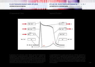 E L E K T R O K A R D I O G R A F I A K O AT L A S A 			 AT L A S D E E L E C T R O C A R D I O G R A F í A / 1 /
OINARRIAK FUNDAMENTOS
/ 44 /
E L E K T R O K A R D I O G R A F I A K O AT L A S A 			 AT L A S D E E L E C T R O C A R D I O G R A F í A / 2 /
INTERPRETATZEKO SISTEMATIKA SISTEMÁTICA DE LA INTERPRETACIÓN
/ 44 /
ST segmentua eta T uhina Segmento ST y onda T
J puntuaren eta T uhinaren artean kokatua dagoen ST segmentuak
bentrikuluaren errepolarizazioaren aurreneko zatia irudikatu edo
ordezkatzen du eta isoelektrikoa da edo bestela desnibel positibo txiki bat
izaten du. Bentrikulu-errepolarizazioaren bigarren zatiak T uhina sortzen
du. ST segmentuaren eta T uhinaren asalduek garrantzi berezia daukate
kardiopatia iskemikoaren diagnostikorako, izan ere miokardioko iskemiak
alterazioak eragiten baititu mintzean zeharreko ekintza-potentzialean.
El segmento ST (entre el punto J y el inicio de la onda T) representa la
primera parte de la repolarización ventricular y es isoeléctrico o con
ligero desnivel positivo. La segunda parte de la repolarización ventricular
da lugar a la onda T. Las alteraciones del segmento ST y de la onda T
tienen especial significación para el diagnóstico de cardiopatía isquémica,
ya que la isquemia miocárdica induce alteraciones en el potencial de acción
transmembrana.
J
ST
T
Na+
Ca++
K+
K+
Na+
Ca++
Na+
Ca++
Na+
Ca++
K+Na+
Ca++
K+
K+
Na+
Ca++
Na+
Ca++
Na+
A -90 mV
B
 