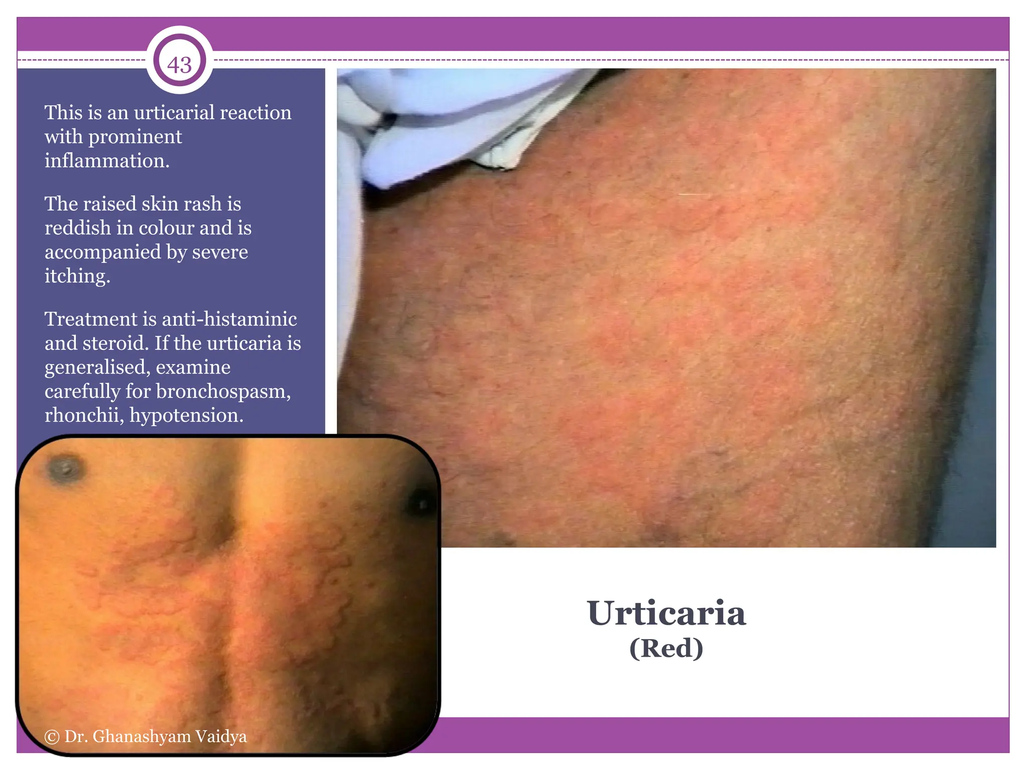 Atlas of skin disorders For General practitioners | PPT