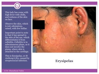 Atlas of skin disorders For General practitioners | PPT