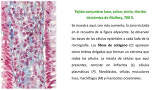 Tejido conjuntivo laxo, colon, simio, tinción
tricrómica de Mallory, 700 Χ.
Se muestra aquí, con más aumento, la zona incluida
en el recuadro de la figura adyacente. Se observan
las bases de las células epiteliales a cada lado de la
micrografía. Las fibras de colágeno (C) aparecen
como hebras delgadas que forman un estroma que
rodea las células. La mezcla de células que aquí
presentes, consiste en linfocitos (L), células
plasmáticas (P), fibroblastos, células musculares
lisas, macrófagos (M) y mastocitos ocasionales.
 