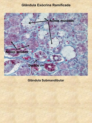 Glândula Exócrina Ramificada
Ductos
Ácinos serosos
Ácinos mucosos
Glândula Submandibular
 