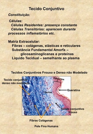 Tecido Conjuntivo
Tecidos Conjuntivos Frouxo e Denso não Modelado
Tecido conjuntivo
frouxo
Tecido conjuntivo
denso não modelado
Fibras Colágenas
Constituição:
Células:
Células Residentes: presença constante
Células Transitórias: aparecem durante
processos inflamatórios etc.
Matriz Extracelular:
Fibras – colágenas, elásticas e reticulares
Substância Fundamental Amorfa –
glicosaminoglicanas e proteínas
Líquido Tecidual – semelhante ao plasma
Queratina
Derme
Pele Fina Humana
 