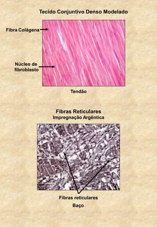 Tecido Conjuntivo Denso Modelado
Fibras Reticulares
Impregnação Argêntica
Fibras reticulares
Núcleo de
fibroblasto
Fibra Colágena
Tendão
Baço
 