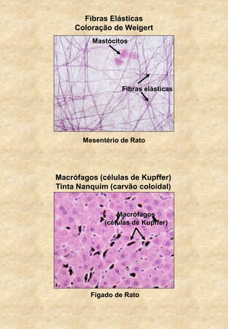 Fibras Elásticas
Coloração de Weigert
Fibras elásticas
Mastócitos
Macrófagos (células de Kupffer)
Tinta Nanquim (carvão coloidal)
Macrófagos
(células de Kupffer)
Mesentério de Rato
Fígado de Rato
 