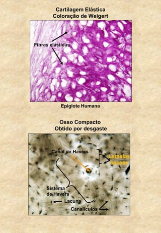 Cartilagem Elástica
Coloração de Weigert
Osso Compacto
Obtido por desgaste
Fibras elásticas
Epiglote Humana
Canal de Havers
Lamelas
ósseas
Lacuna
Canalículos
Sistema
de Havers
 