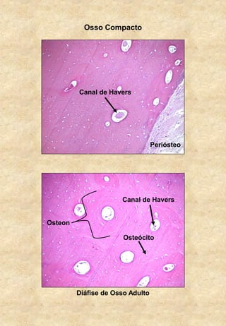 Osso Compacto
Periósteo
Canal de Havers
Canal de Havers
Osteon
Osteócito
Diáfise de Osso Adulto
 