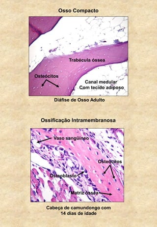 Osso Compacto
Canal medular
Com tecido adiposo
Trabécula óssea
Osteócitos
Ossificação Intramembranosa
Matriz óssea
Osteócitos
Vaso sangüíneo
Osteoblasto
Diáfise de Osso Adulto
Cabeça de camundongo com
14 dias de idade
 