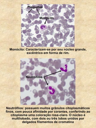 Neutrófilos: possuem muitos grânulos citoplasmáticos
finos, com pouca afinidade por corantes, conferindo ao
citoplasma uma coloração rosa-claro. O núcleo é
multilobado, com dois ou três lobos unidos por
delgados filamentos de cromatina
Neutrófilos
Monócito: Caracterizam-se por seu núcleo grande,
excêntrico em forma de rim.
Monócito
Plaquetas
 
