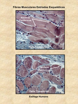Fibras Musculares Estriadas Esqueléticas
Esôfago Humano
Corte Transversal
Corte Longitudinal
Núcleos
Periféricos
Núcleos
Periféricos
 