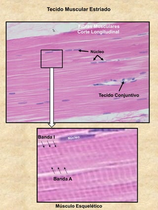 Tecido Muscular Estriado
Banda A
Banda I
Músculo Esquelético
Tecido Conjuntivo
Núcleo
Fibras Musculares
Corte Longitudinal
 