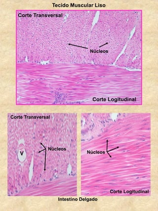 Tecido Muscular Liso
Intestino Delgado
Corte Logitudinal
Corte Transversal
Núcleos
Núcleos
Núcleos
Corte Transversal
Corte Logitudinal
V
 