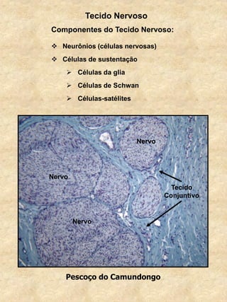 Componentes do Tecido Nervoso:
 Neurônios (células nervosas)
 Células de sustentação
 Células da glia
 Células de Schwan
 Células-satélites
Tecido Nervoso
Pescoço do Camundongo
Nervo
Nervo
Nervo
Tecido
Conjuntivo
 