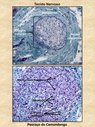 Pescoço do Camundongo
Gânglio
nervoso Tecido
conjuntivo
Vaso
Sangüeneo
Tecido Nervoso
Núcleo com Nucléolo
Neurônio
Células
satélites
 