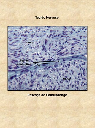 Tecido Nervoso
Pescoço do Camundongo
Nervo
Nervo
Tecido
conjuntivo
 