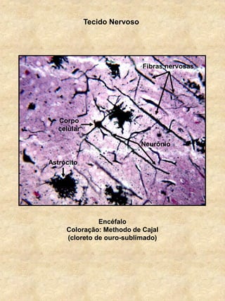 Tecido Nervoso
Encéfalo
Coloração: Methodo de Cajal
(cloreto de ouro-sublimado)
Astrócito
Neurônio
Corpo
celular
Fibras nervosas
 