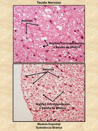 Medula Espinhal
Substância Branca
Tecido Nervoso
Axônios
Regiões Correspondentes
a Bainha de Mielina
Regiões Correspondentes
a Bainha de Mielina
Axônios
 