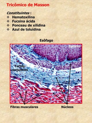 Tricômico de Masson
Constituintes :
 Hematoxilina
 Fucsina ácida
 Ponceau de xilidina
 Azul de toluidina
Esôfago
Epitélio
Tecido
conjuntivo
Fibras musculares Núcleos
 