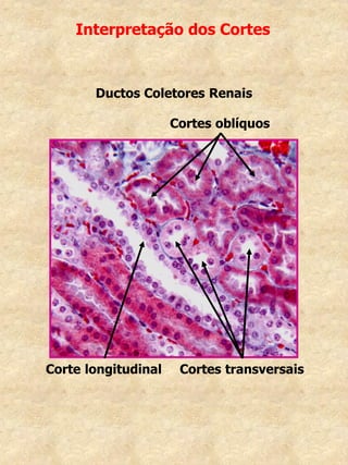 Interpretação dos Cortes
Corte longitudinal Cortes transversais
Ductos Coletores Renais
Cortes oblíquos
 