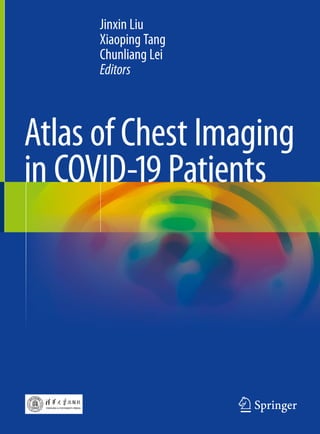 Jinxin Liu
Xiaoping Tang
Chunliang Lei
Editors
Atlas of Chest Imaging
in COVID-19 Patients
 