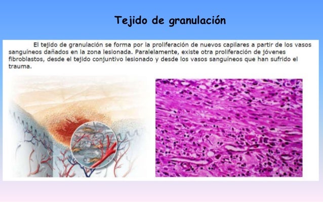Atlas lesiones periapicales