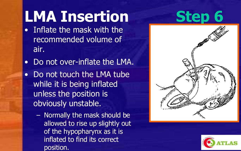 Laryngeal Mask Airway & Igel An Introduction