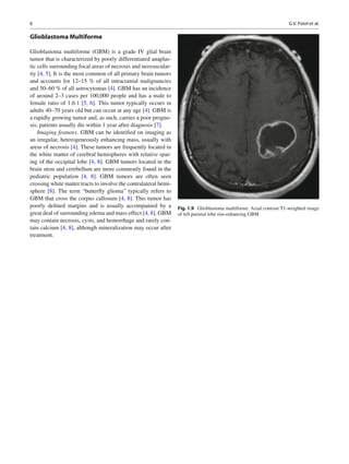 Atlas of brain and spine oncology imaging | PDF