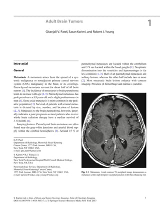 1S. Karimi (ed.), Atlas of Brain and Spine Oncology Imaging, Atlas of Oncology Imaging,
DOI 10.1007/978-1-4614-5653-7_1, © Springer Science+Business Media New York 2013
Intra-axial
General
Metastasis. A metastasis arises from the spread of a sys-
temic malignancy or nonadjacent primary central nervous
system (CNS) malignancy to the brain or its coverings.
Parenchymal metastases account for about half of all brain
tumors [1]. The incidence of metastases to brain parenchyma
tends to increase with age [2, 3]. Parenchymal metastasis has
peak prevalence at 65 years old and a slight predominance in
men [1]. Extra-axial metastasis is more common in the pedi-
atric population [3]. Survival of patients with cranial metas-
tasis is dictated by size, number, and location of lesions
[2, 3]. Metastasis to the brain parenchyma, however, gener-
ally indicates a poor prognosis as most patients who receive
whole brain radiation therapy have a median survival of
3–6 months [1].
Imaging features. Parenchymal brain metastases are often
found near the gray-white junctions and arterial blood sup-
ply within the cerebral hemispheres [3]. Around 15 % of
parenchymal metastases are located within the cerebellum
and 3 % are located within the basal ganglia [1]. Neoplastic
dissemination into the ventricles and leptomeninges is far
less common [1, 3]. Half of all parenchymal metastases are
solitary lesions, whereas the other half include two or more
[2]. Most metastatic brain lesions enhance with contrast
imaging. Presence of hemorrhage and edema is variable.
Adult Brain Tumors
Gitanjali V. Patel, Sasan Karimi, and Robert J. Young
1
G.V. Patel
Department of Radiology, Memorial Sloan-Kettering
Cancer Center, 1275 York Avenue, MRI-1156,
New York, NY 10065, USA
e-mail: gita.patel@gmail.com
S. Karimi • R.J. Young(*)
Department of Radiology,
New York Presbyterian Hospital/Weill Cornell Medical College,
New York, NY, USA
Neuroradiology Service, Department of Radiology,
Memorial Sloan-Kettering Cancer Center,
1275 York Avenue, MRI-1156, New York, NY 10065, USA
e-mail: karimis@mskcc.org; youngr@mskcc.org
Fig. 1.1 Metastasis. Axial contrast T1-weighted image demonstrates a
metastasis at the right temporo-occipital junction with thin enhancing rim
 