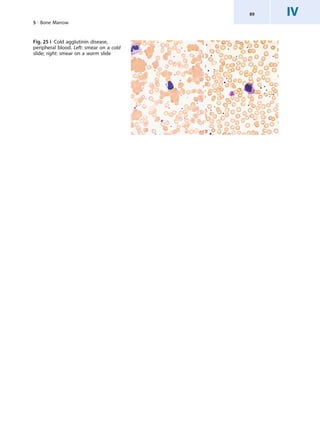Atlas_of_Clinical_Hematology_6.pdf