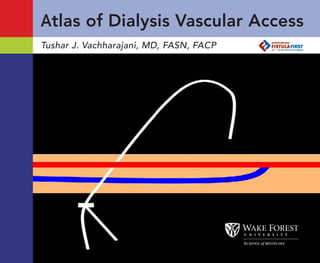 Fibrin sheath
Atlas of Dialysis Vascular Access
Tushar J. Vachharajani, MD, FASN, FACP
 