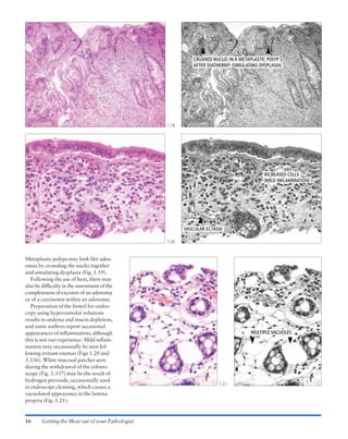 Atlas of gastrointestinal endoscopy and related pathology (blackwell ...