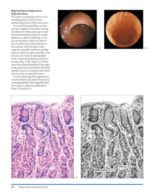 Atlas of gastrointestinal endoscopy and related pathology (blackwell ...