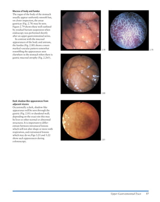 Atlas of gastrointestinal endoscopy and related pathology (blackwell ...