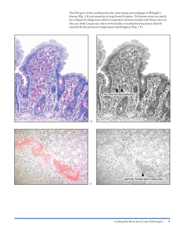 Atlas of gastrointestinal endoscopy and related pathology (blackwell,…