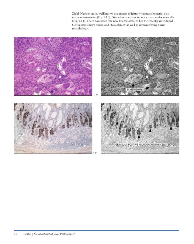 Atlas of gastrointestinal endoscopy and related pathology (blackwell,…